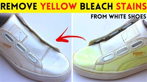 baking soda to get yellowing out of sneakers